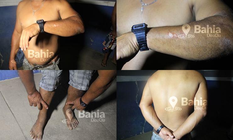 Fretista foi agredido por trs bandidos. (Foto: Alex Barbosa/Bahia Dia a Dia).