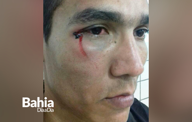 rbitro Leonardo de Oliveira Carvalho foi agredido por jogadores durante uma partida pelo intermunicipal. (Foto: Reproduo/Whatsapp)