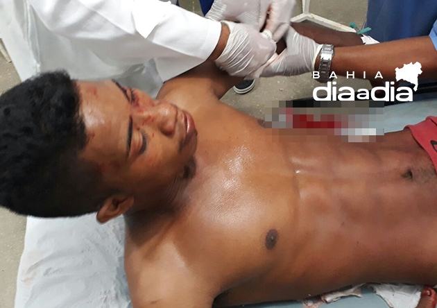 Riviomarques Custdio Alves de 22 anos, foi baleado no brao e atingido com golpe de faco no rosto. (Foto: BAHIA DIA A DIA)