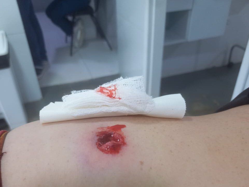 Produtor rural foi baleado na regio do abdmen durante a invaso  Fazenda